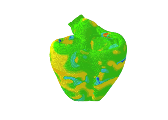 heart simulation